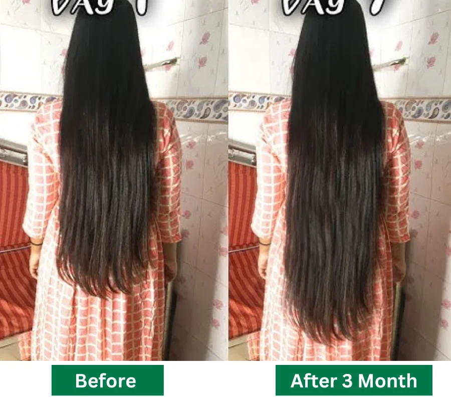 Before After Result 3